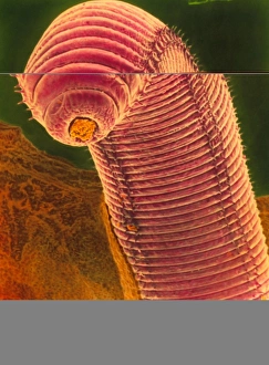 Coloured SEM of an earthworm, Lumbricus t Coloured SEM of an earthworm, Lumbricus t