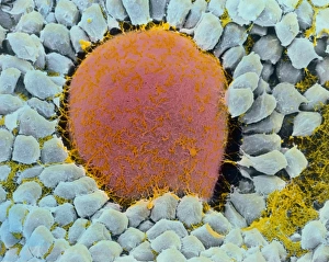 Coloured SEM of egg cell in secondary follicle Coloured SEM of egg cell in secondary follicle