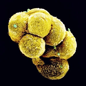 Coloured SEM of an embryo at the stage of morula Coloured SEM of an embryo at the stage of morula