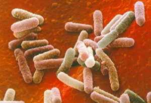 Coloured SEM Print of Escherichia coli Bacteria