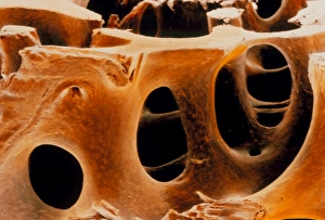 Coloured SEM of femoral spongy bone tissue Coloured SEM of femoral spongy bone tissue