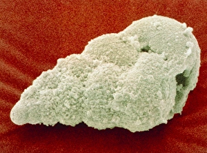 Coloured SEM of Foraminifera Textularia sp. fossil Coloured SEM of Foraminifera Textularia sp. fossil