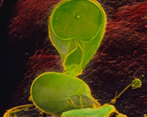 Coloured SEM of Giardia lamblia in human intestine Coloured SEM of Giardia lamblia in human intestine