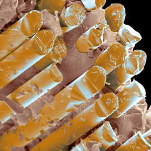Coloured SEM of a glass fibre dental ceramic Coloured SEM of a glass fibre dental ceramic