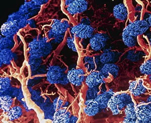 Coloured SEM of glomeruli in the human kidney Coloured SEM of glomeruli in the human kidney