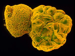 Coloured SEM of a hatching blastocyst 5 days old Coloured SEM of a hatching blastocyst 5 days old
