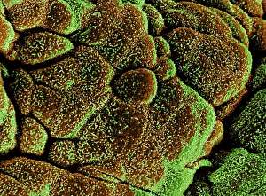 Coloured SEM of healthy bladder epithelium Coloured SEM of healthy bladder epithelium