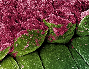 Coloured SEM of iris epithelial cells of the eye Coloured SEM of iris epithelial cells of the eye