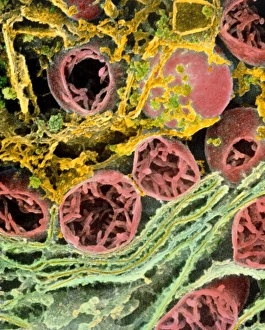 Coloured SEM of mitochondria & ER in a liver cell Coloured SEM of mitochondria & ER in a liver cell