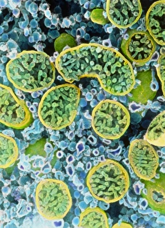 Coloured SEM of mitochondria in ovarian cells Coloured SEM of mitochondria in ovarian cells