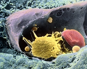 Coloured SEM of a monocyte in a blood capillary Coloured SEM of a monocyte in a blood capillary