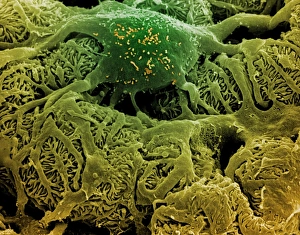 Coloured SEM of podocytes in the human kidney Coloured SEM of podocytes in the human kidney