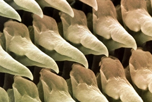 Coloured SEM of the radula of the garden slug Coloured SEM of the radula of the garden slug