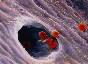 Coloured SEM of red blood cells in blood vessel Coloured SEM of red blood cells in blood vessel
