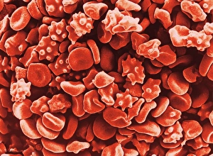 Coloured SEM of red blood cells (erythrocytes) Coloured SEM of red blood cells (erythrocytes)
