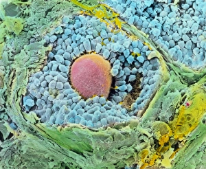 Coloured SEM of secondary follicles in the ovary Coloured SEM of secondary follicles in the ovary