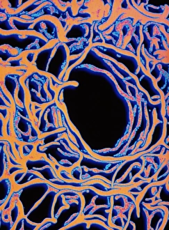 Coloured SEM of section through human spleen Coloured SEM of section through human spleen