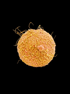 Coloured SEM of sperm on egg during fertilisation Coloured SEM of sperm on egg during fertilisation