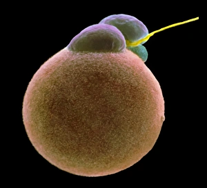 Coloured SEM of sperm fertilising an egg Coloured SEM of sperm fertilising an egg