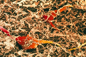 Coloured SEM of spinal cord nerve cells Coloured SEM of spinal cord nerve cells