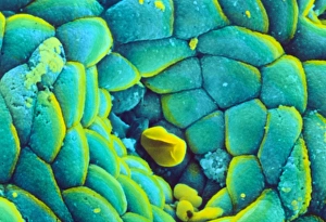 Coloured SEM of the stomach mucosa & gastric pit Coloured SEM of the stomach mucosa & gastric pit
