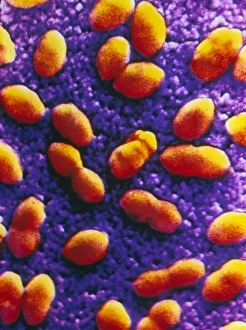 Coloured SEM of streptococcus pneumoniae Coloured SEM of streptococcus pneumoniae