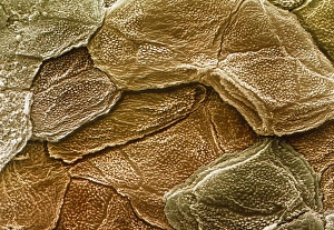 Coloured SEM of the surface of human skin Coloured SEM of the surface of human skin