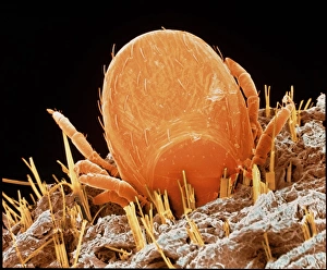Coloured SEM of a tick (Ixodes sp.) in human skin Coloured SEM of a tick (Ixodes sp.) in human skin