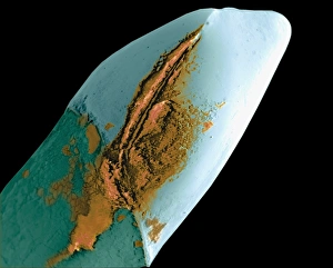 Coloured SEM of a tooth with a dental crown Coloured SEM of a tooth with a dental crown