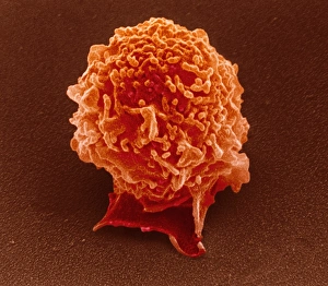 Coloured SEM of a white blood cell (lymphocyte) Coloured SEM of a white blood cell (lymphocyte)