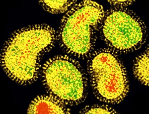 Coloured TEM of a cluster of influenza viruses Coloured TEM of a cluster of influenza viruses