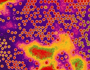 Coloured TEM of clusters of polio viruses (type 1) Coloured TEM of clusters of polio viruses (type 1)