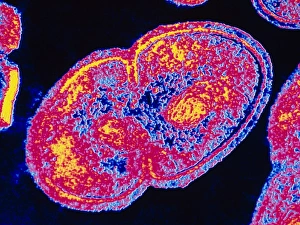 Coloured TEM of Enterococcus faecalis Coloured TEM of Enterococcus faecalis