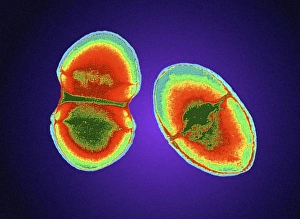 Coloured TEM of Enterococcus sp. bacteria Coloured TEM of Enterococcus sp. bacteria