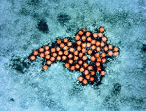 Coloured TEM of foot & mouth disease viruses Coloured TEM of foot & mouth disease viruses