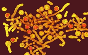 Coloured TEM of hepatitis B virus and its antigen Coloured TEM of hepatitis B virus and its antigen