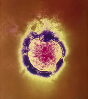 Coloured TEM of the measles virus Coloured TEM of the measles virus
