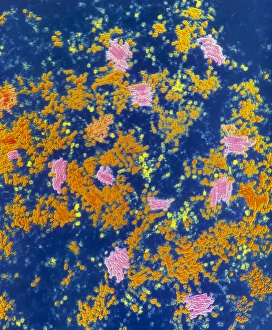 Coloured TEM of the Pea Enation Mosaic virus Coloured TEM of the Pea Enation Mosaic virus