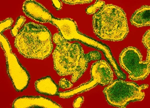 Coloured TEM of respiratory syncytial (RSV) virus Coloured TEM of respiratory syncytial (RSV) virus