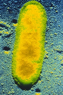 Coloured TEM of Rickettsiae bacterium Coloured TEM of Rickettsiae bacterium