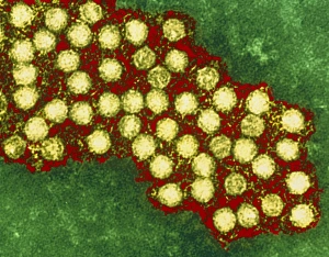 Coloured TEM of unidentified enteroviruses Coloured TEM of unidentified enteroviruses