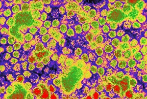 Coloured TEM of yellow fever viruses Coloured TEM of yellow fever viruses