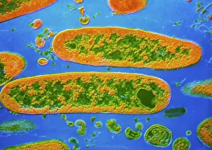 Coloured TEM of Yersinia pestis bacteria Coloured TEM of Yersinia pestis bacteria