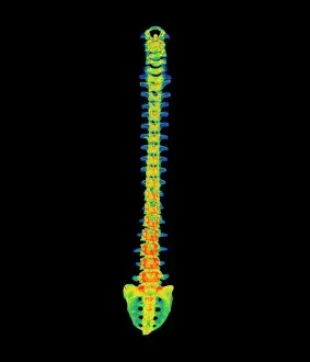 Images Dated 30th August 2002: Coloured X-ray of a healthy human spine