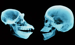 Coloured X-ray of human and chimpanzee sk Coloured X-ray of human and chimpanzee sk