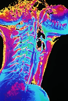 Coloured X-ray of a normal neck in profile Coloured X-ray of a normal neck in profile