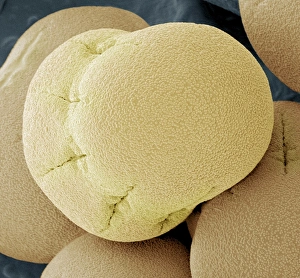 Pollen Grain Structure Prints: Comfrey pollen, SEM