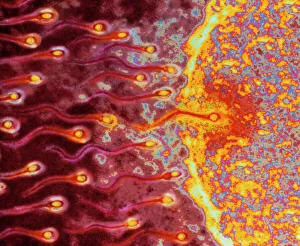 Computer art of sperm and egg during fertilisation Computer art of sperm and egg during fertilisation