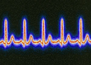 Computer artwork of healthy ECG trace of the heart Computer artwork of healthy ECG trace of the heart
