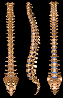 Computer artwork of three views of a human spine Computer artwork of three views of a human spine